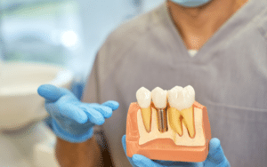 what is the role of dental implants in oral health