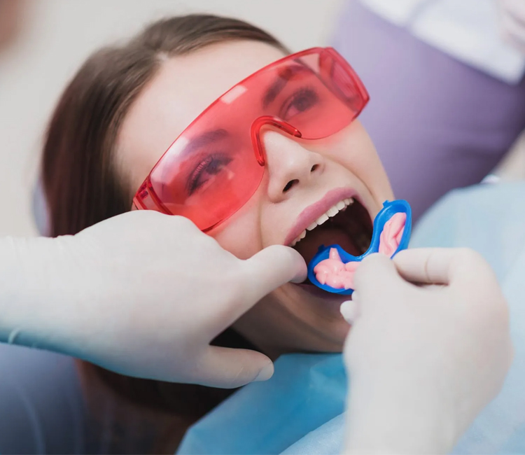 flouride treatment peabody