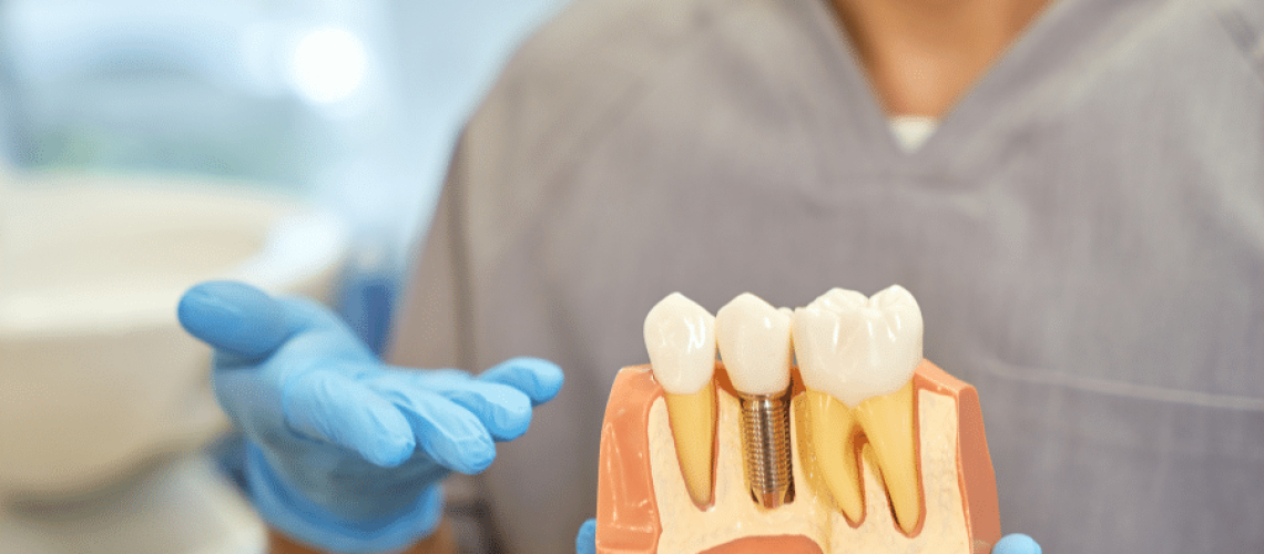 what is the role of dental implants in oral health